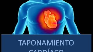 Taponamiento cardíaco  Fisiopatología [upl. by Acirfa]