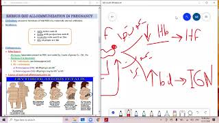 د السكري erythroblastosis fetalis rh [upl. by Novello]