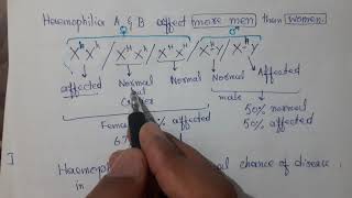Genetics of Haemophilia  X Linked RecessiveTrait  Pedigree  Failure of Blood Clot [upl. by Htiek]