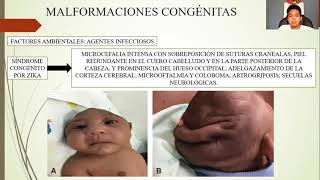 EMBRIOLOGÍA DEFECTOS CONGÉNITOS Y DIAGNÓSTICO PRENATAL [upl. by Prudy]