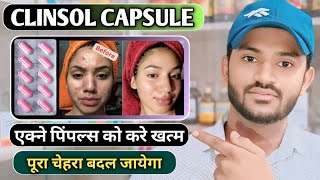 Clinsol capsule uses in hindi how to take clinsol capsule full review in hindi [upl. by Grimona]