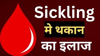 Sickling मे थकान का इलाज।Sickle cell anemia [upl. by Neahs395]