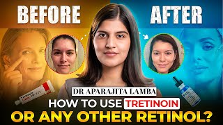 How to use TRETINOIN Cream ❌🚀 RETINOIDS Explained in detail By DERMATOLOGIST✅  Dr Aparajita Lamba [upl. by Salkcin548]