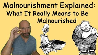 Malnourishment Explained What It Really Means To Be Malnourished malnourished Diet [upl. by Rik]