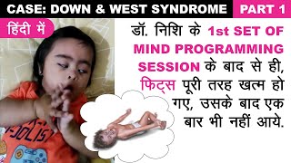 200 SEIZURES पूरी तरह ख़त्म हो गएडॉनिशी भट्ट के एक ही सेशन के बाद CaseDownamp West Syndrome Part 1 [upl. by Elison471]