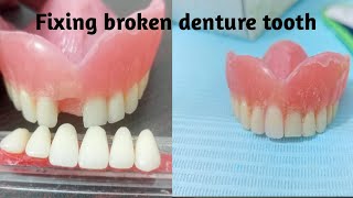 How to fix broken denture tooth [upl. by Namhcan]