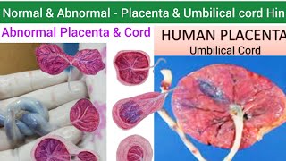 Human Placenta  Structure Function amp Abnormalities of Placenta amp Umbilical cord  Umbilical Cord [upl. by Aidas]