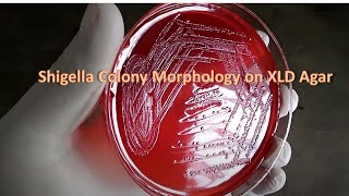 Shigella colony morphology on XLD agar [upl. by Niamjneb701]