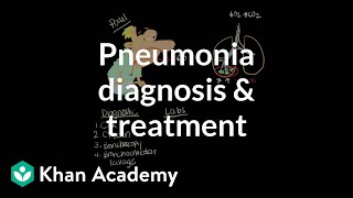 Pneumonia diagnosis and treatment  Respiratory system diseases  NCLEXRN  Khan Academy [upl. by Anitnuahs446]