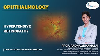 Ophthalmology  Hypertensive retinopathy  Raaonline [upl. by Morville]