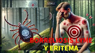 Eritema Multiforme por HerpesMicoplasma vs Eritema Migrans por Enfermedad de Lyme usmle [upl. by Alesram735]