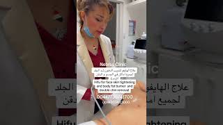 HIFU الهايفو 00447736741700 اكسبلور skincare تجميل المستوي neckexercises beauty التركيز [upl. by Jonie]