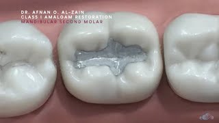 Class I amalgam restoration – Mandibular molar 47  Arabic عربي [upl. by Carnay]