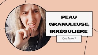 •▪︎》Comment affiner un grain de peau irrégulier granuleux [upl. by Edualcnaej]