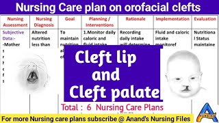 Nursing Care Plan on Cleft lip and cleft palateNursing care plan for cleft lip and cleft palate [upl. by Kirsti]