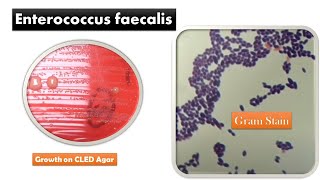 Enterococcus faecalis Colony Morphology and Gram Staining [upl. by Englebert]