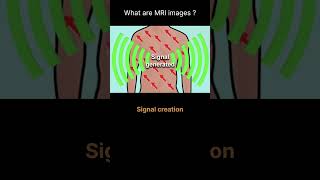 Signal creation Quiz 10 radiologychannel007 [upl. by Ardnuat]