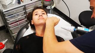 Cryo facial frotox with kaasenlife by TruCryo [upl. by Daraj28]