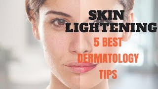 SKIN LIGHTENING 5 Best Dermatology Tips [upl. by Ennayr83]