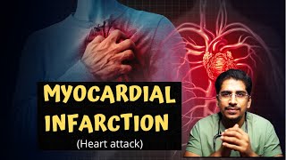 MYOCARDIAL INFARCTION MI  Heart attack in 20mins [upl. by Yelsehc974]