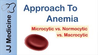 Anemia  Microcytic vs Normocytic vs Macrocytic [upl. by Carlita60]