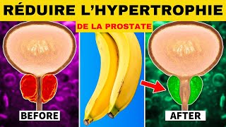 Top 6 des fruits pour réduire une hypertrophie de la prostate [upl. by Iy]