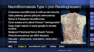 MedPix Video  The Phakomatoses von Recklinghausen Neurofibromatosis NF1 [upl. by Zetnas]