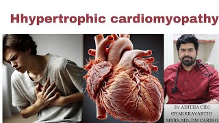 Hypertrophic Cardiomyopathy Everything You Need to Know In Tamil [upl. by Ycnaffit952]