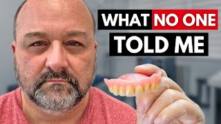 3 Things I Wish I Knew Before Getting Dentures [upl. by Akinet]