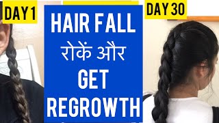 How to Stop Hair Fall Immediately at Home for female  Part 2   Self Care Secrets [upl. by Viv28]