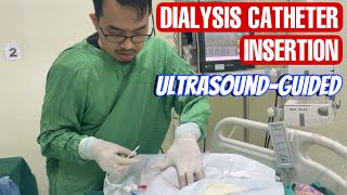 Dialysis catheter insertion  pemasangan CDL catheter double lumen [upl. by Malas341]