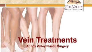 Vein Treatments [upl. by Newkirk]