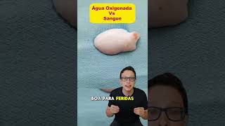 Água oxigenada X Sangue 😯🩸curiosidades medicina medico dicas experimento ciencia enfermagem [upl. by Brunk]