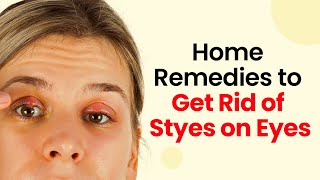 Eye Stye Solutions Rapid and Safe Treatments You Can Try Now [upl. by Studley]