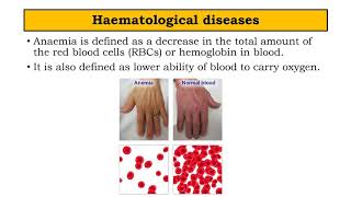 Haematological diseases  BPharm SEM II Pathophysiology by Manjushree Pawar [upl. by Fidelis886]