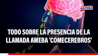 🔴🔵Nuevo caso de amebiasis en Lima Todo sobre la presencia de la llamada ameba comecerebros [upl. by Alverta]