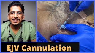 EJV External Jugular Vein Cannulation in 5 mins [upl. by Publea406]