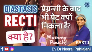 प्रेग्नन्सी के बाद भी पेट निकला हुआ What is Diastasis Recti Part 1  Dr Neeraj Pahlajani [upl. by Barnet]