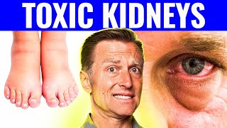 7 Warning Signs That Your Kidneys Are Toxic [upl. by Tterrag228]