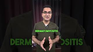 Prodoc Tip 47 Dermatomyositis and Importance of Malignancy Screening USMLE NEETPG [upl. by Tyra]