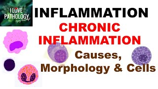 INFLAMMATION 8 CHRONIC INFLAMMATION Causes Morphology amp Cells [upl. by Bilski522]