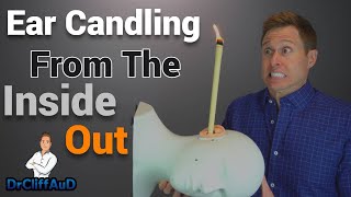 Ear Candle Wax Removal Experiment  See INSIDE the Ear Canal while Ear Candling 😮 [upl. by Kidder852]