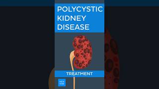 Polycystic kidney disease Treatment  Kenhub polycystickidneydisease [upl. by Catha]