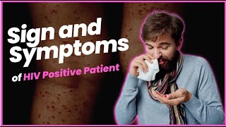 Sign and Symptoms of HIV Positive Patient [upl. by Havens]