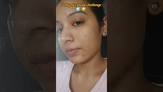 FACE icing on oily acne prone skin oilyskin acnetreatment skincare skincareroutine acnescars [upl. by Aral]