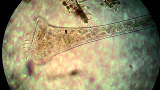 Protist under the microscope [upl. by Jilly]