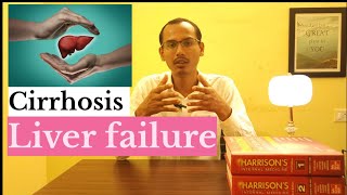 Cirrhosiscauses symptoms investigations treatmentfattyliver cirrhosis alcohol doctor [upl. by Idnew]