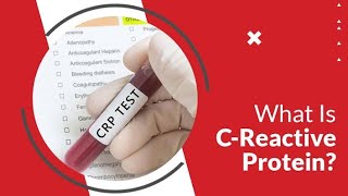 What is CRP TEST Dr Health Officials [upl. by Issak]