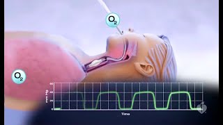 Capnography Made Easy [upl. by Rauscher414]