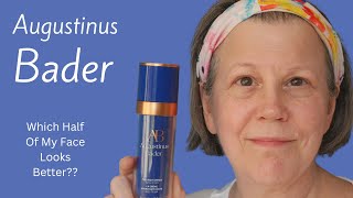 Using Augustinus Bader On Half My Face For 12 Months  Did It Help [upl. by Cami889]